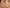 Sérum Clareador TopSkin®