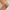 Sérum Clareador TopSkin®