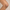 Sérum Clareador TopSkin®